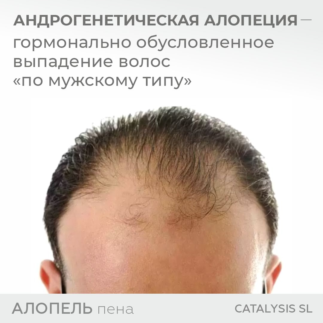 О чем еще говорить накануне 23 февраля, как не о наших любимых мужчинах и их «мужских проблемах»?!